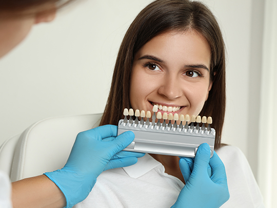 Unlocking Your Perfect Smile: A Comprehensive Guide to Dental Veneers in Houston